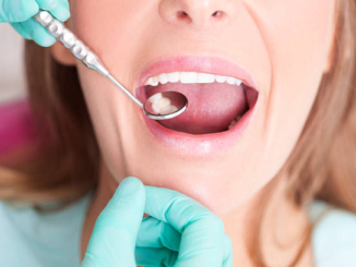 Tooth decay: avoid it, don’t fix it