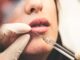 Filler addiction: getting that Insta look